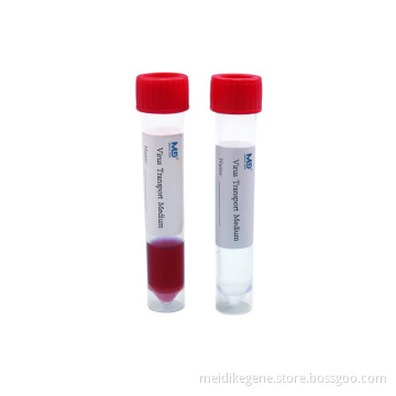 10-in-1 VTM Kits 10ml Mixed Virus Sampling Tube for Covid-19 Testing